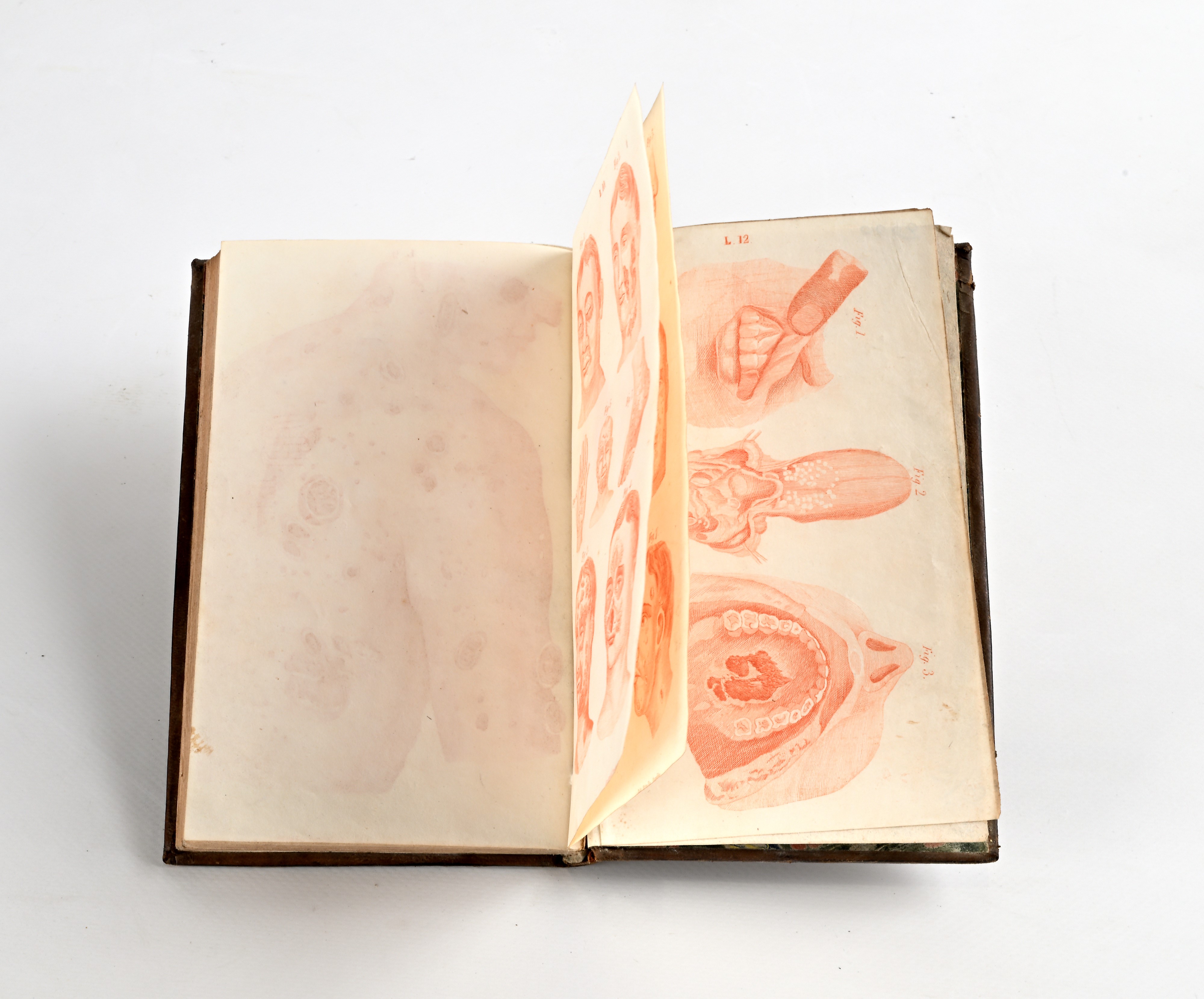 Samuel La Mert - La Preservacion personal o tratado mèdico popular sobre las enfermedades de la j...